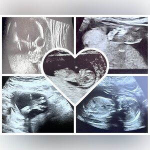 BABY ON THE WAY - HOLY COW!